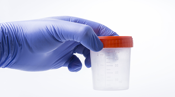 Urine Drug Testing Facts: What You Need to Know